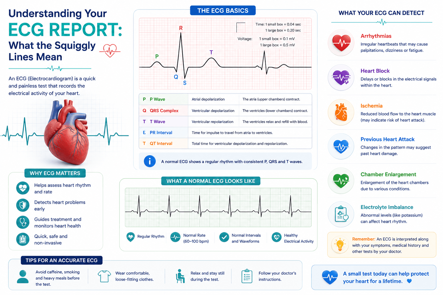 ECG report showing normal sinus rhythm with labeled P wave QRS complex and T wave