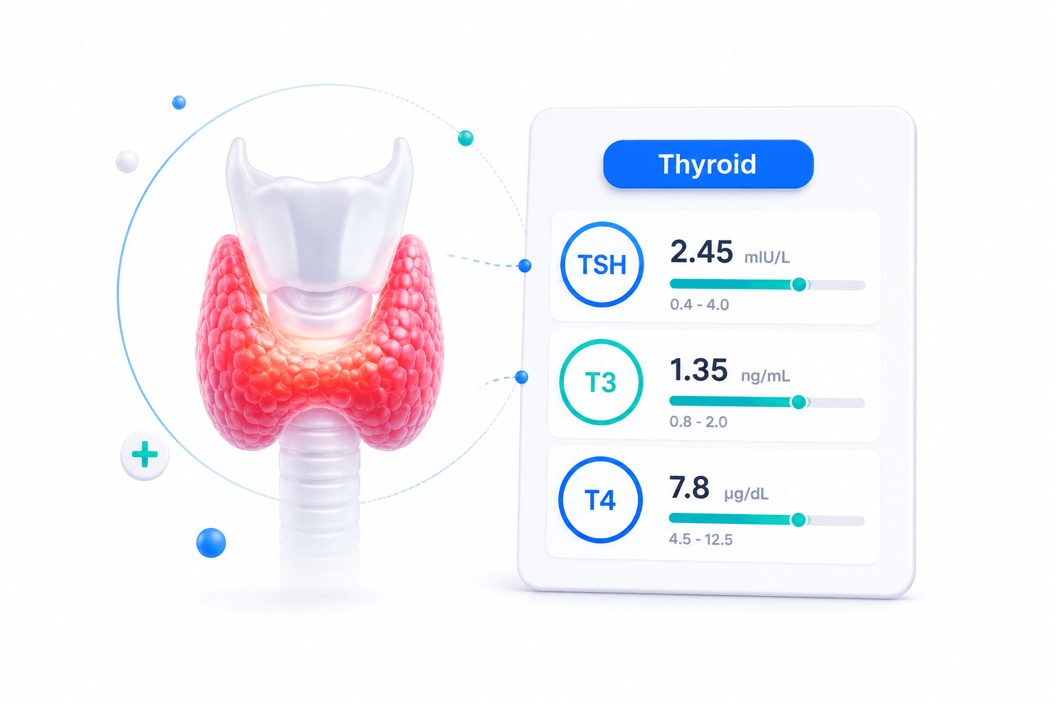 Thyroid function test report showing TSH, T3, and T4 values with reference ranges
