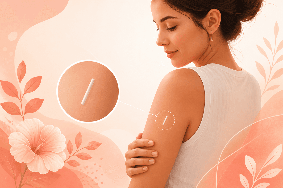 Educational illustration related to the Nexplanon contraceptive implant and common side effects counseling