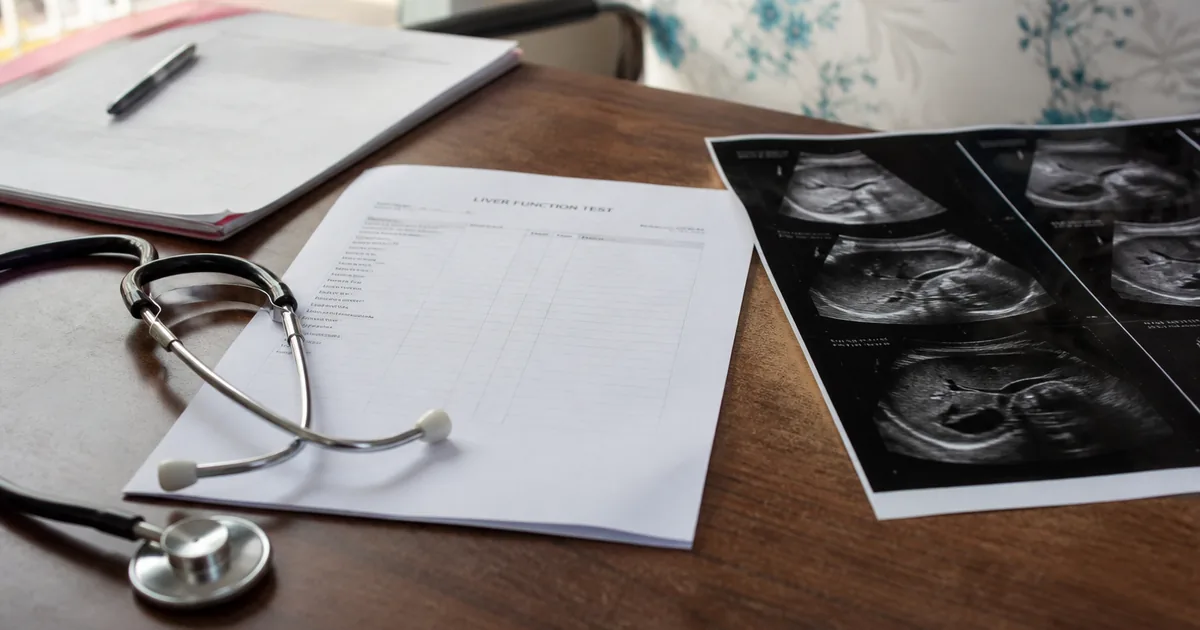 Liver-function paperwork beside an abdominal ultrasound film on a clinic desk